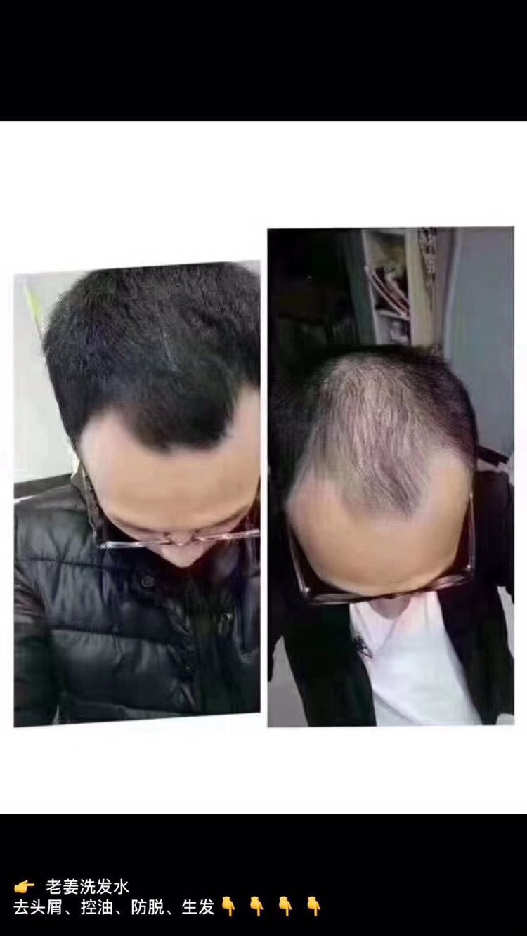 生姜洗护育发 专门改善头皮毛囊问题