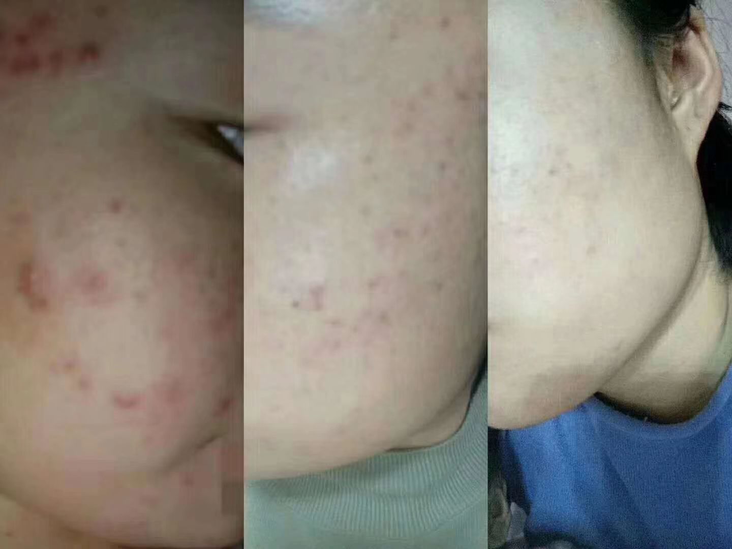 万能牛奶布丁霜，还你婴儿般的肌肤