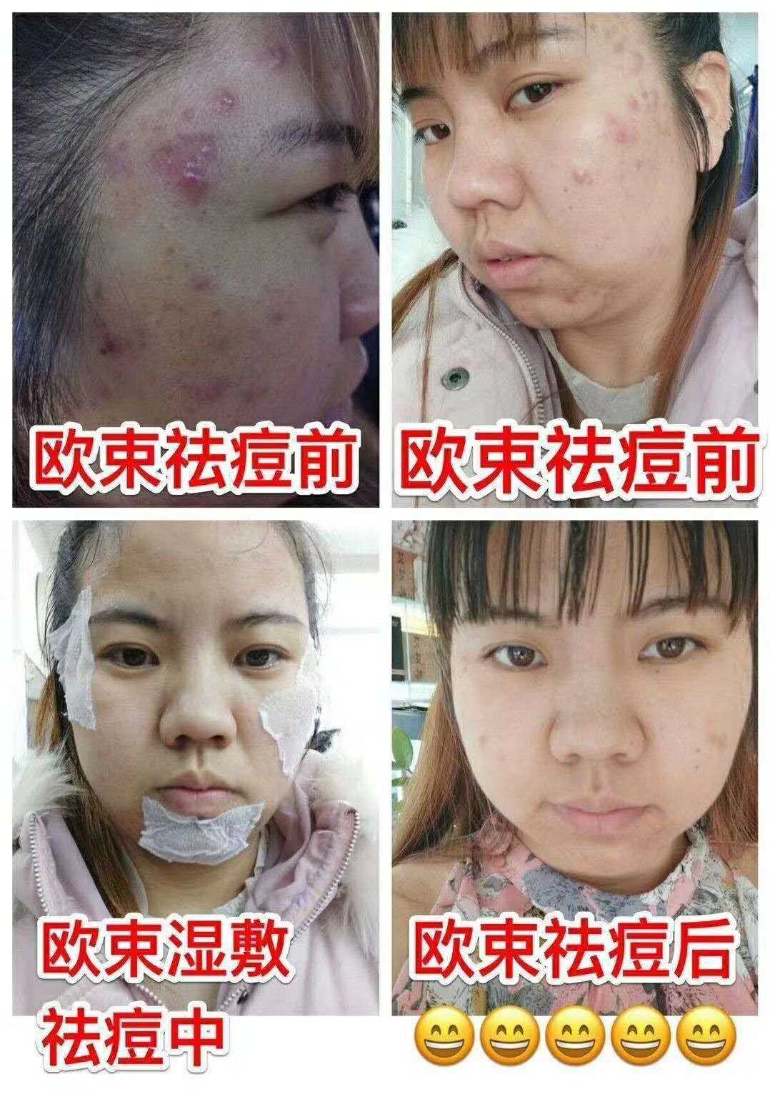 欧束品牌招代理 一对一培训 保你出单