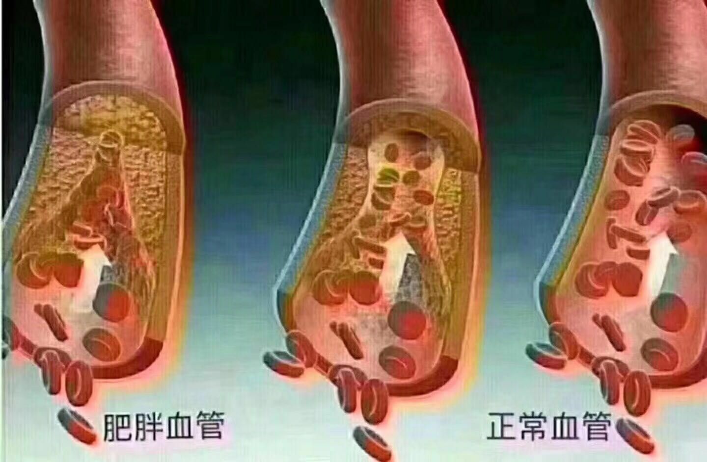 CVG益生菌燕窝膳食