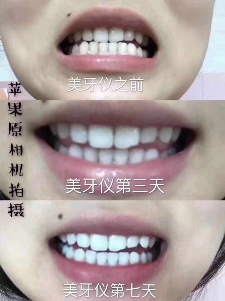 碧缇福美牙仪招合伙人