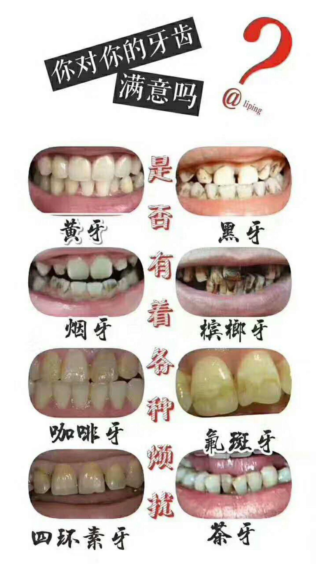 专业美白牙齿，无效退款