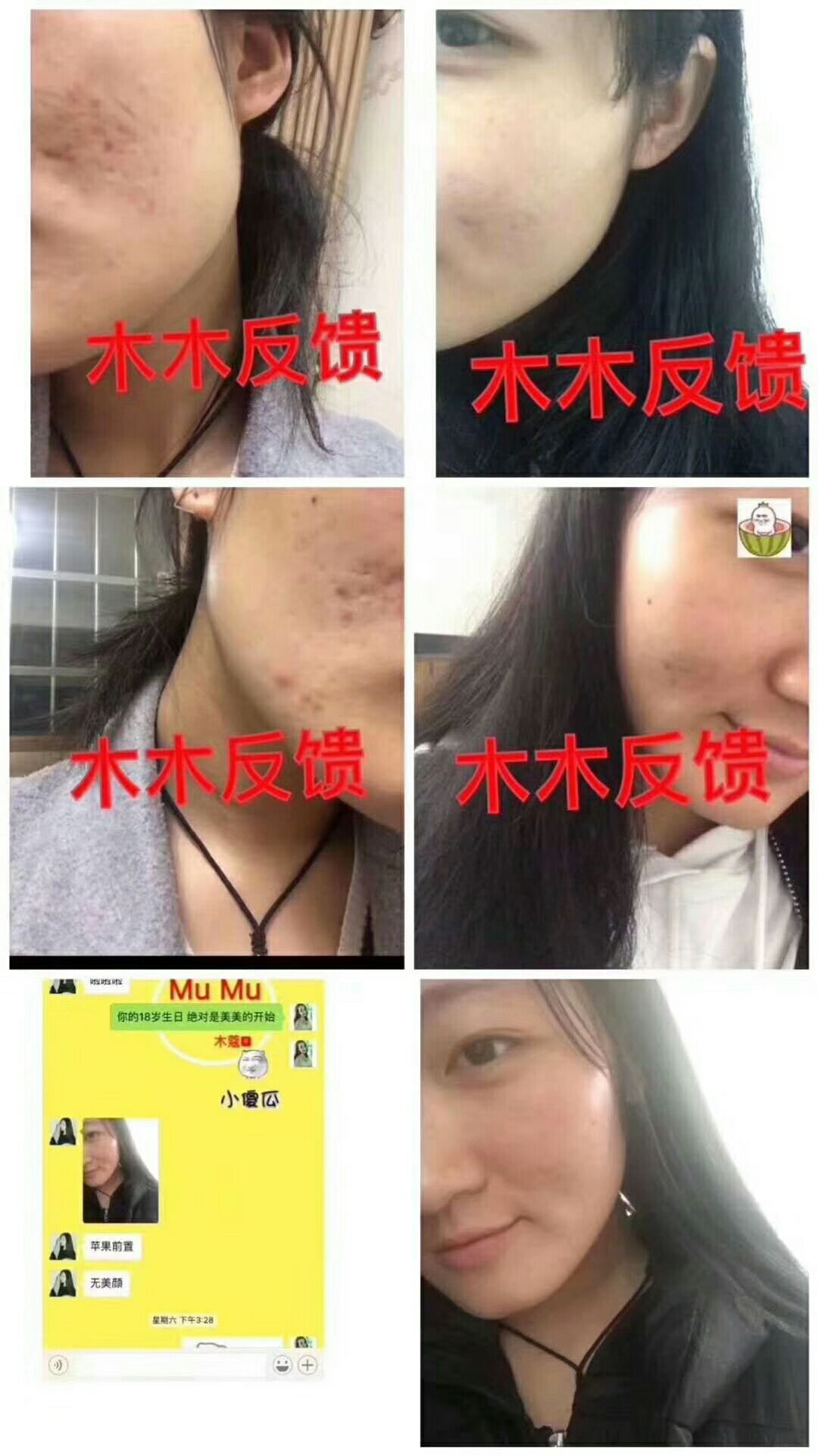 木蔻臻颜美肌霜 男女通用