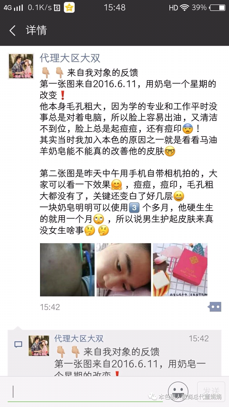 洗脸美白祛痘战术，洗出白嫩嫩，做女人就做本色丽人