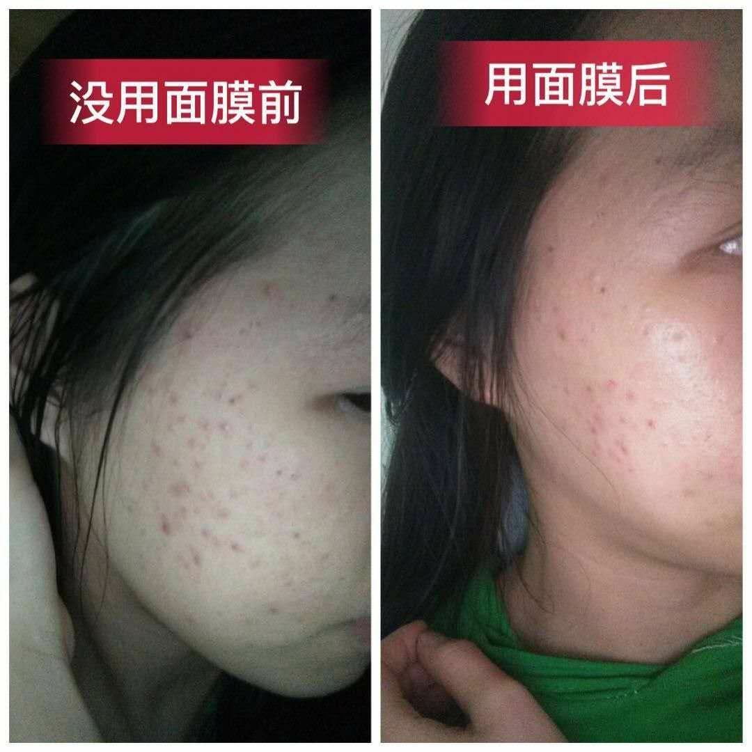 冰亦花瓣面膜，小仙女们都很喜欢