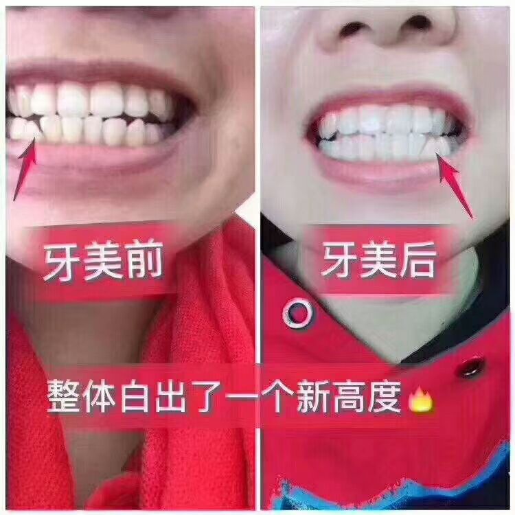 正品南京同仁堂牙美