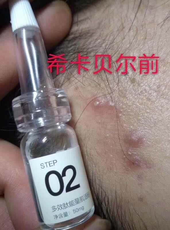 法国西卡贝尔面膜使用方法及使用反馈【梵大集团】
