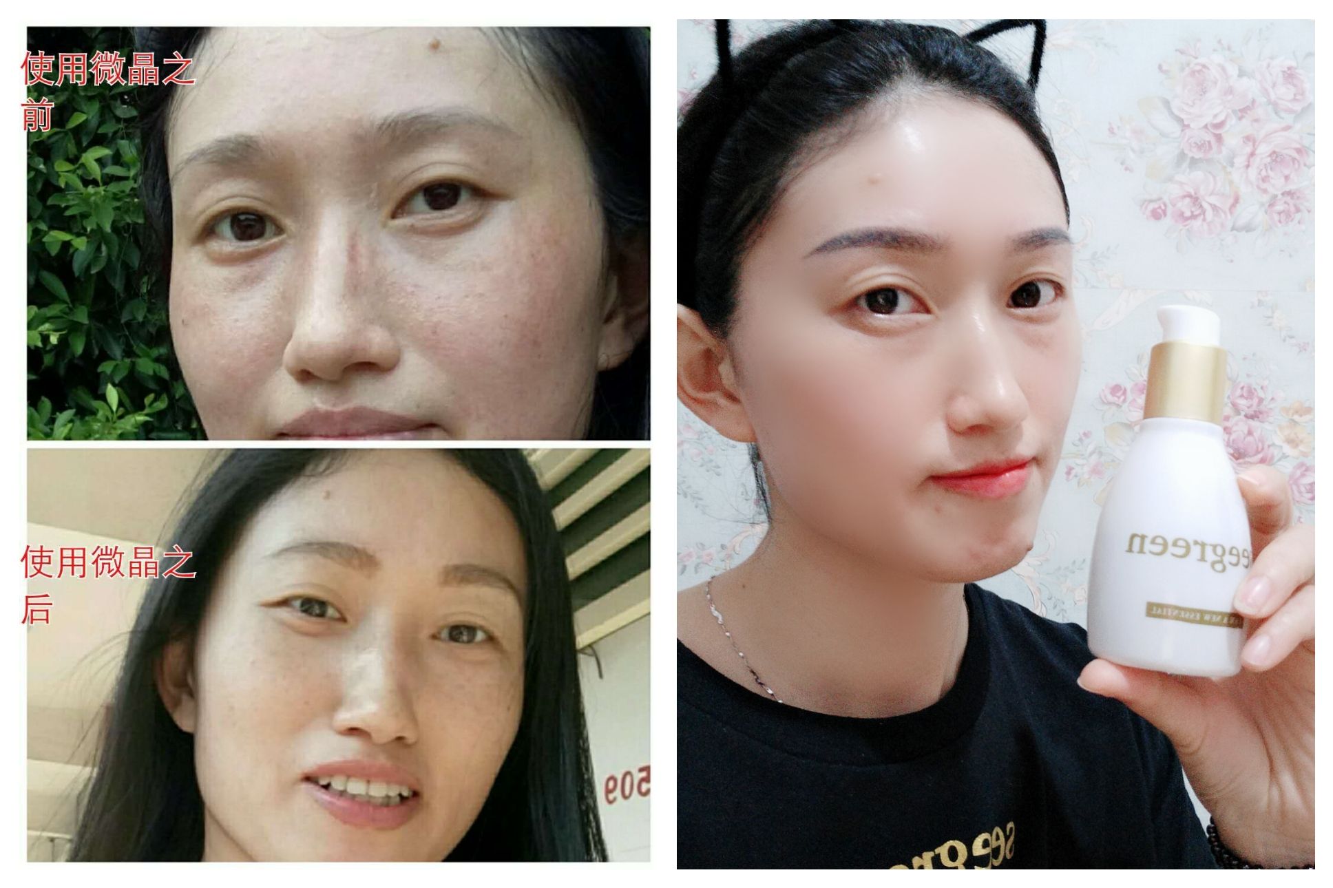微晶焕活清肌精华 全国诚招代理 欢迎各位有梦想的小伙加入