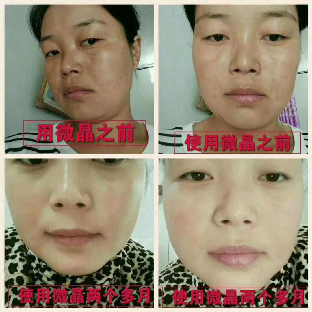 微晶焕活清肌精华 全国诚招代理 欢迎各位有梦想的小伙加入