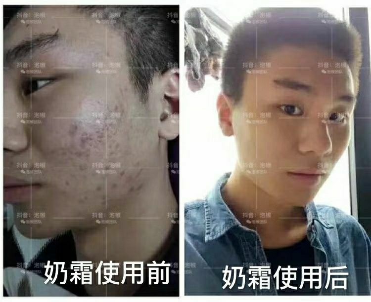 根据你的情况改善你的皮肤，让你的皮肤变得更好！成为美丽的小仙