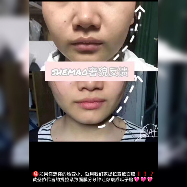 奢貌瘦脸面膜 女人必看 效果非常明显