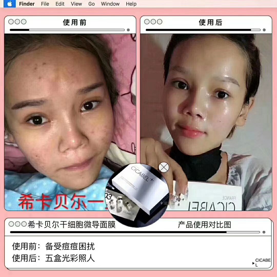 希卡贝尔干细胞面膜