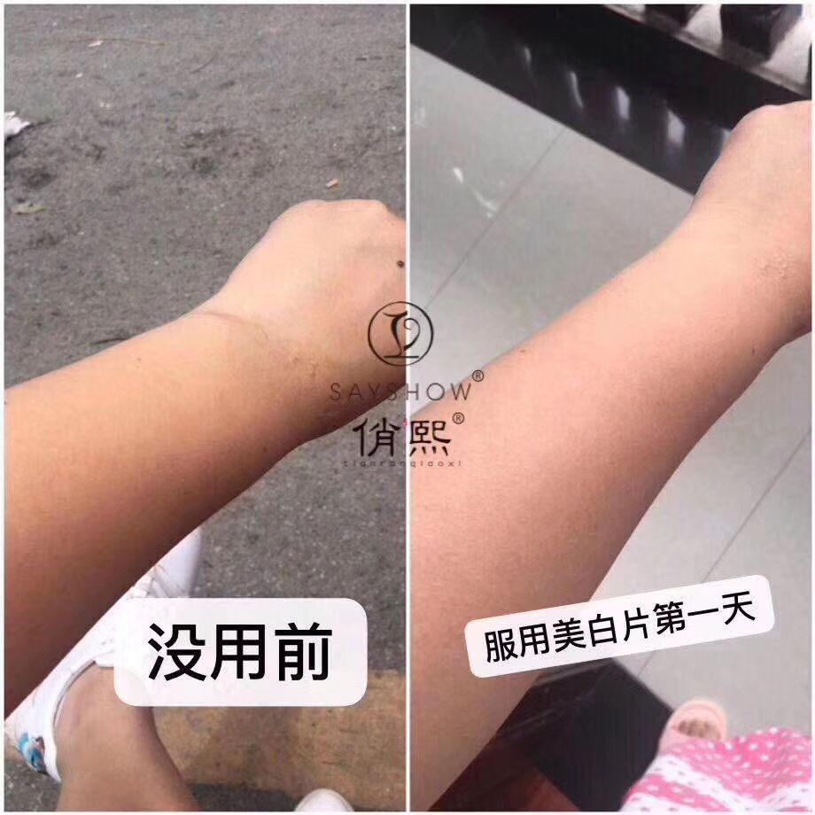 俏熙胶原蛋白肽美白片