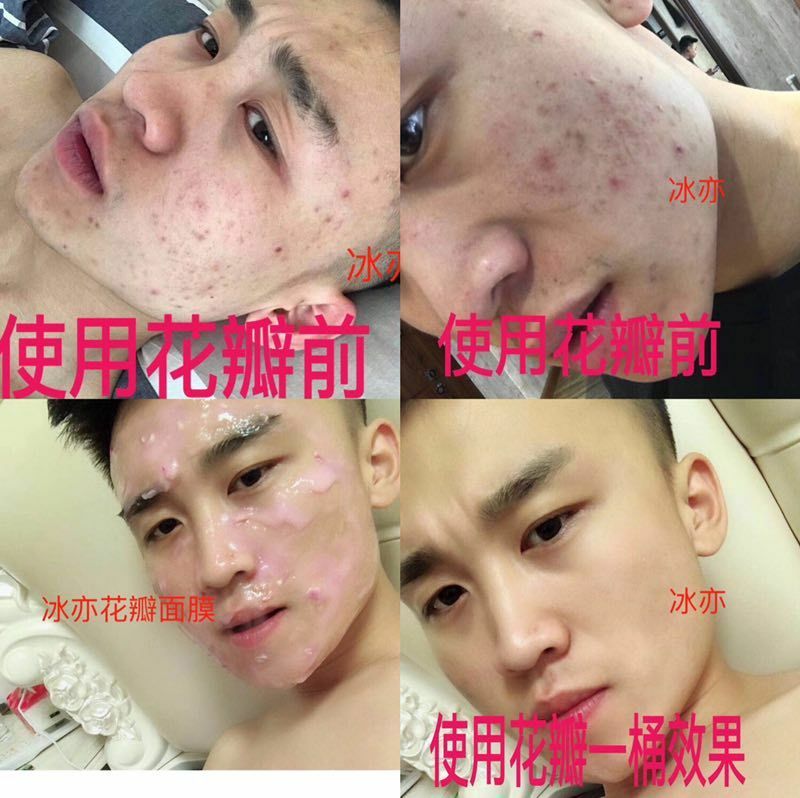 冰亦花瓣面膜，小仙女们都很喜欢