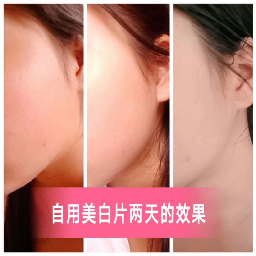 俏熙胶原蛋白肽美白片