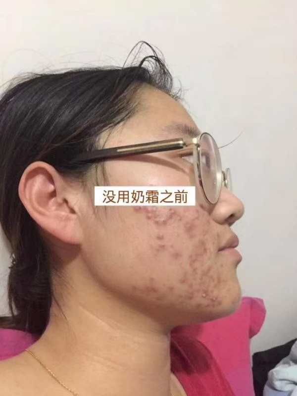 护肤品推荐。