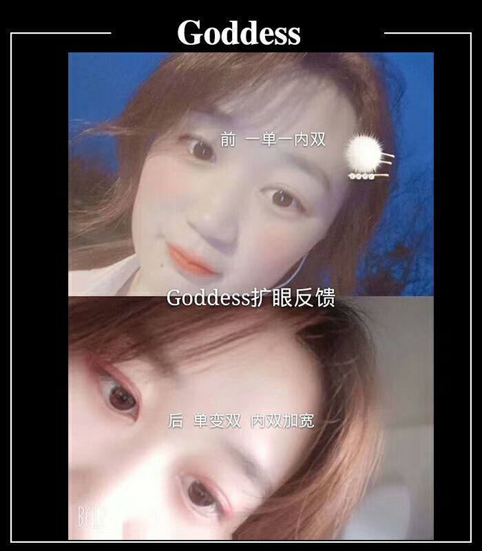 单眼皮美女变双眼皮美女哦，只需要简单的按摩而已