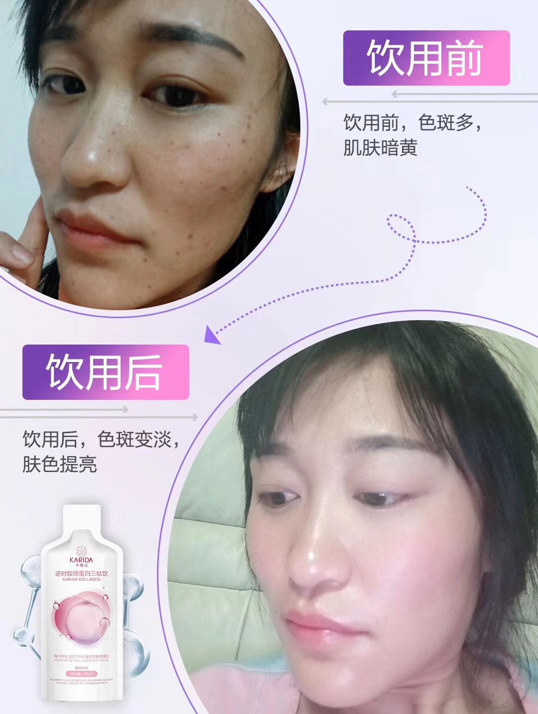 卡维达胶原蛋白抗衰美白