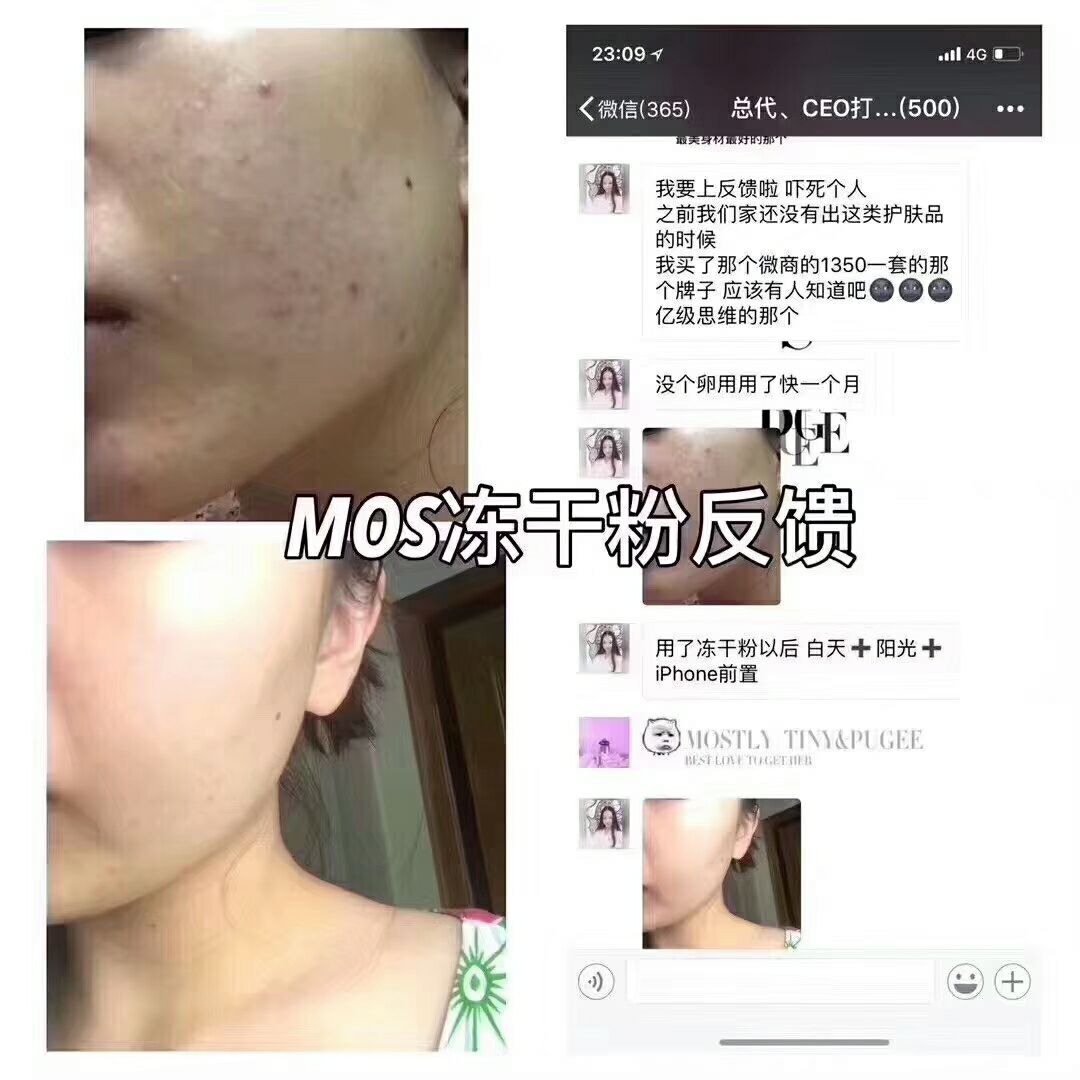 冻干粉-----