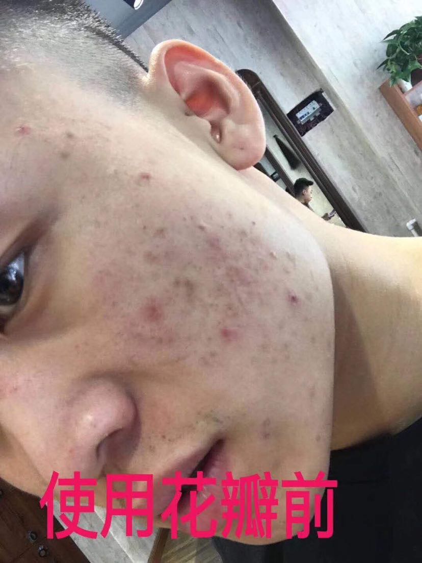 冰亦花瓣面膜 彩妆