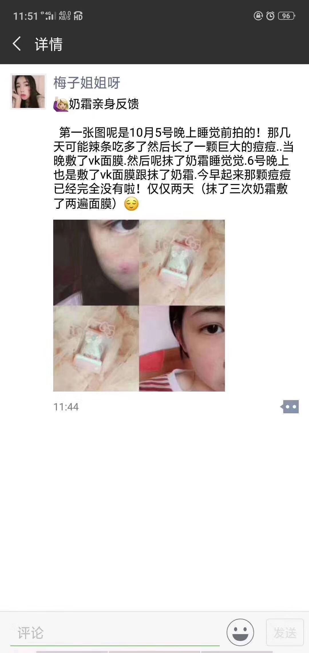 去痘，去油，去痘印，万能奶霜