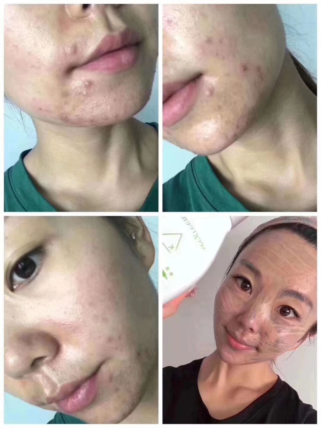 微晶焕活清肌精华 全国诚招代理 欢迎各位有梦想的小伙加入