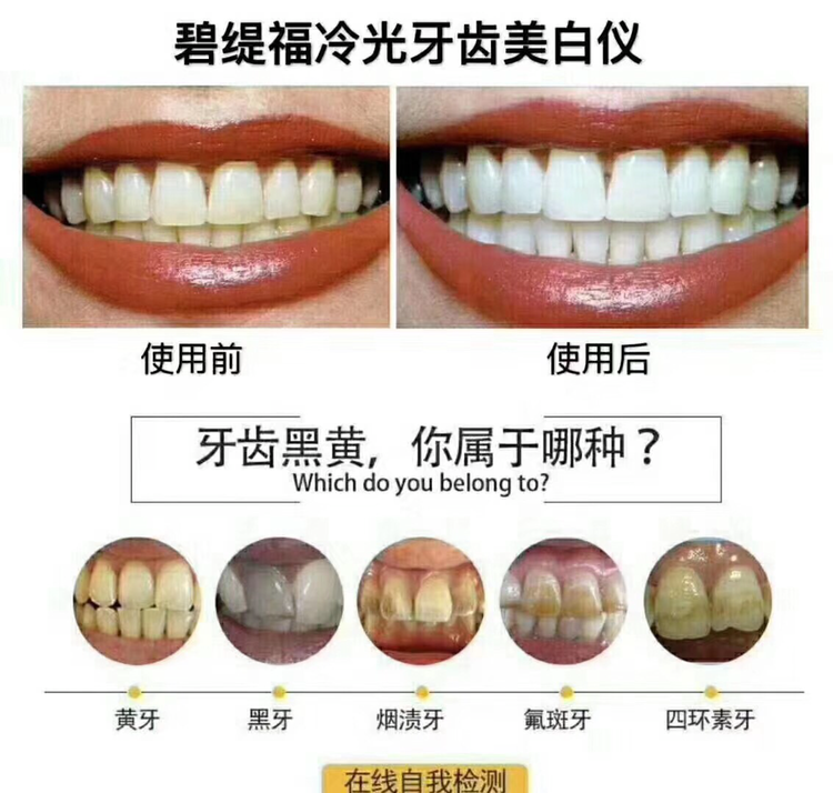 碧缇福美牙仪招合伙人