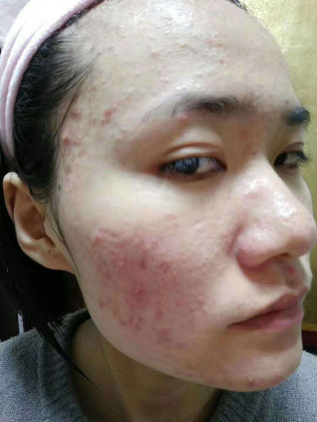 溪秀小绿盒面膜 补水，去痘 特别好用