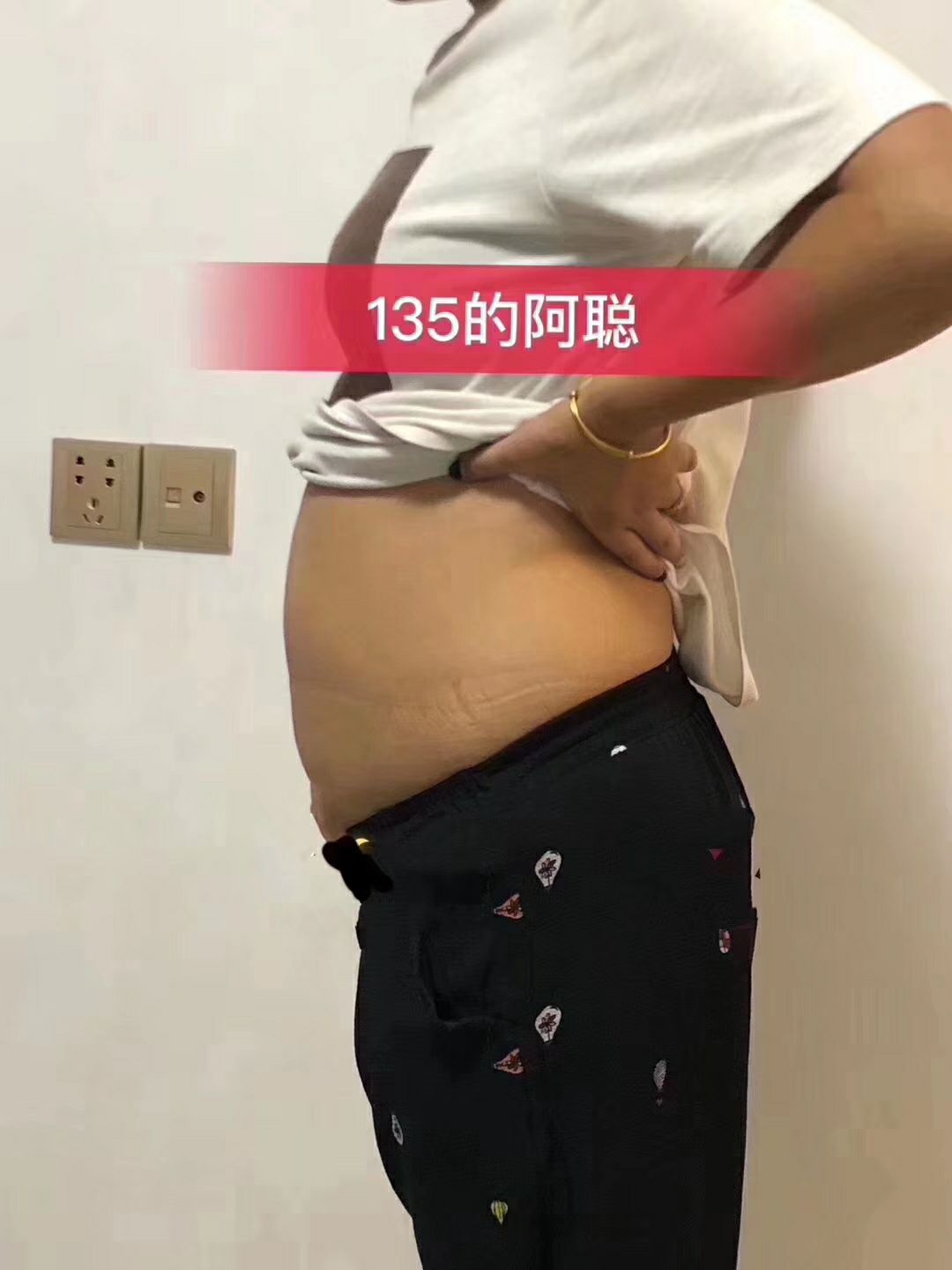 夏天来拉  又到了露肉的季节 ~