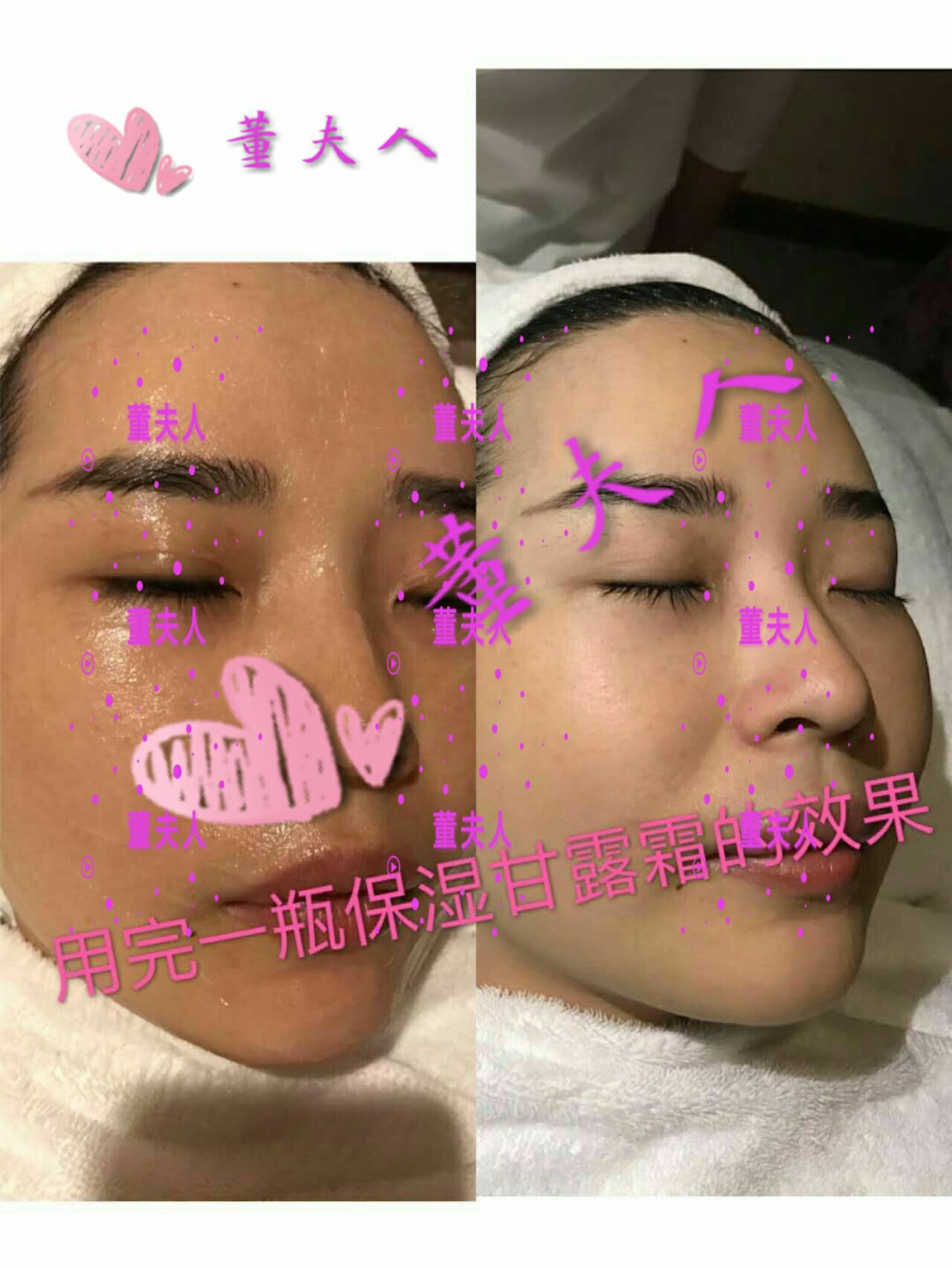 董夫人甘露保湿霜  快速修复皮膜