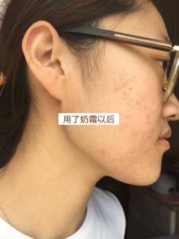 护肤品推荐。