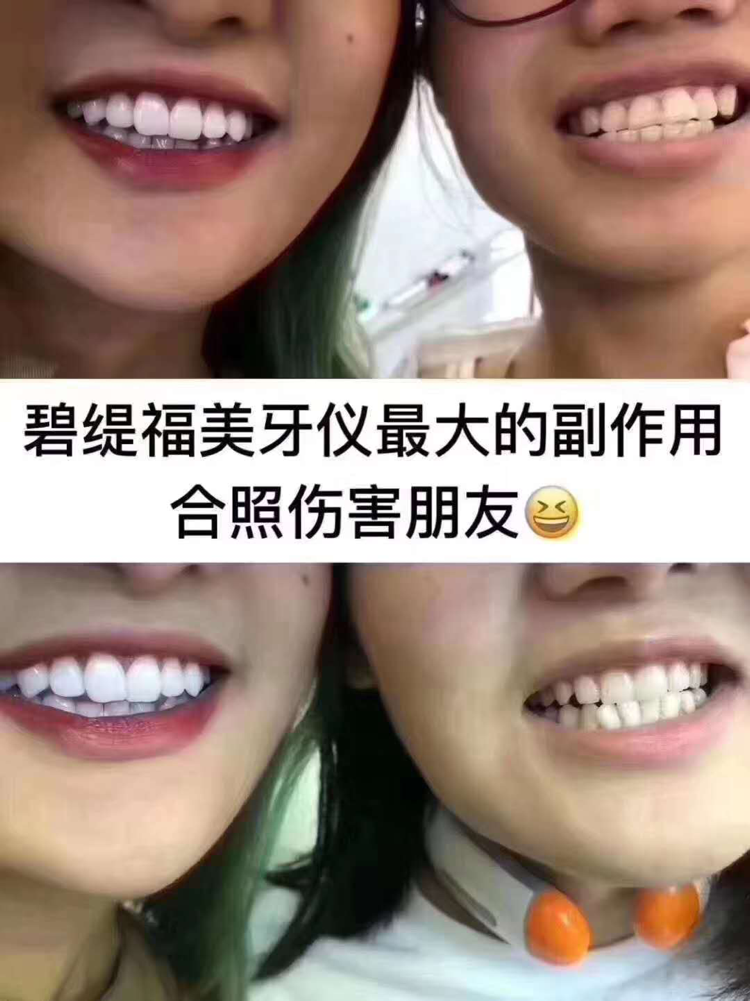 ❥认真坚持用过碧缇福美牙仪的人从来没有一个让我失望的[呲牙]