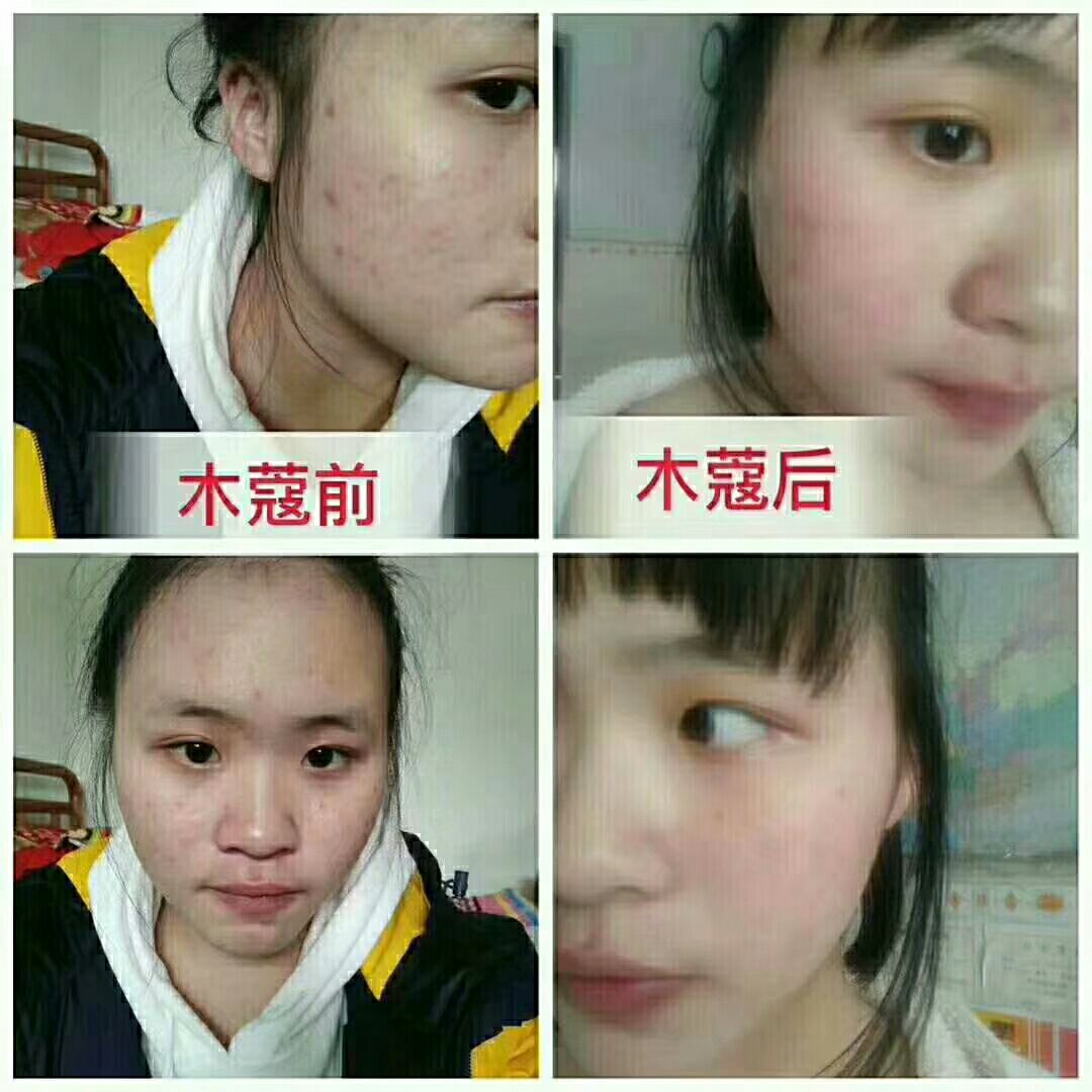 木蔻臻颜美肌霜 男女通用