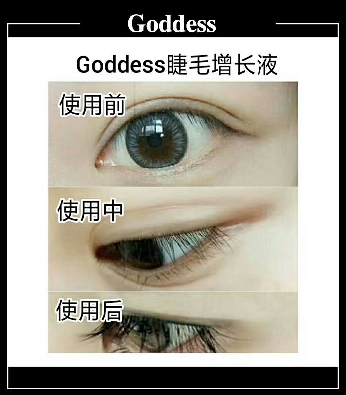 单眼皮美女变双眼皮美女哦，只需要简单的按摩而已