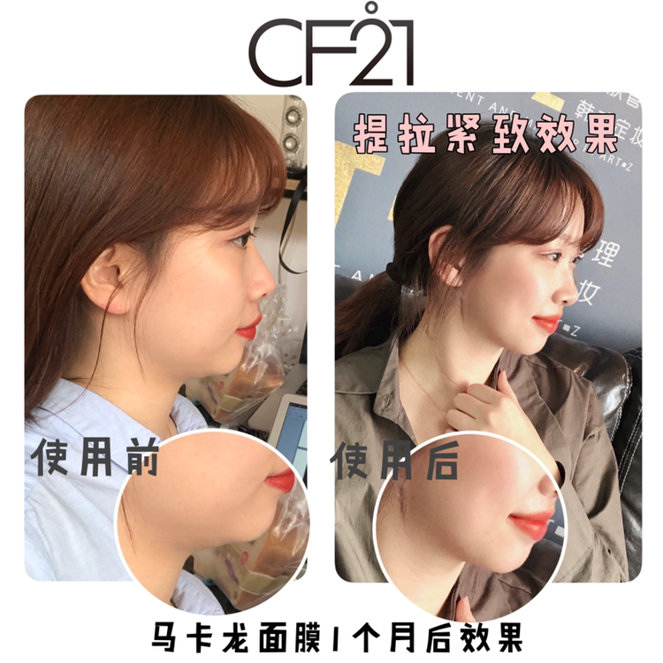 CF21马卡龙瘦脸面膜 招商