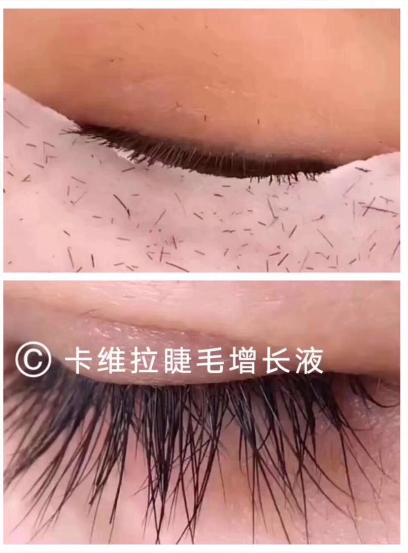 睫毛增长液，专业增长增密无效退款