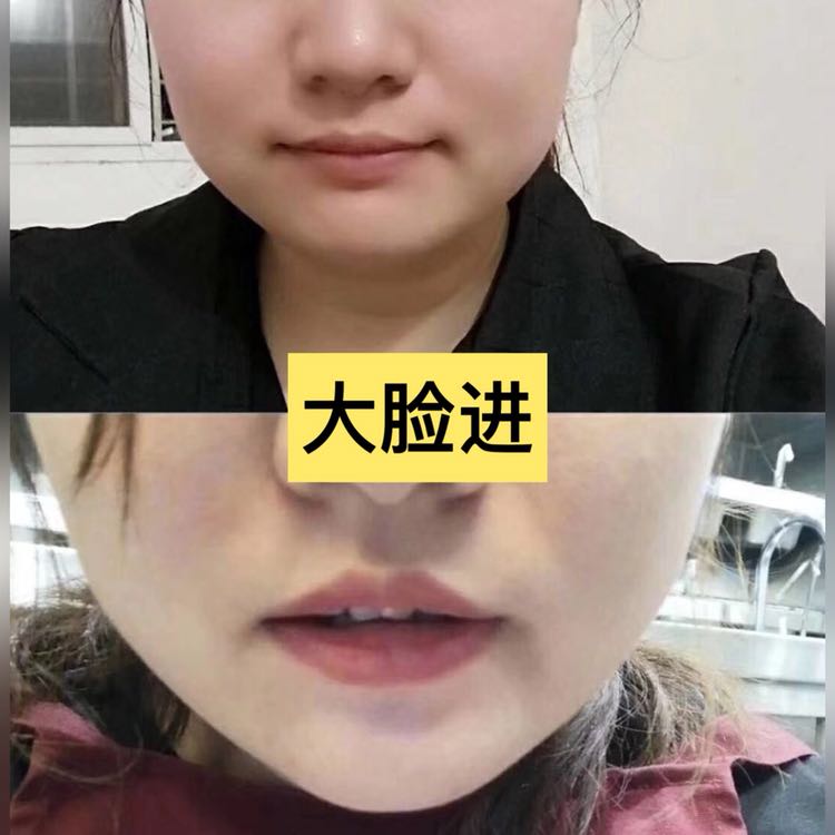 奢貌瘦脸面膜 女人必看 效果非常明显
