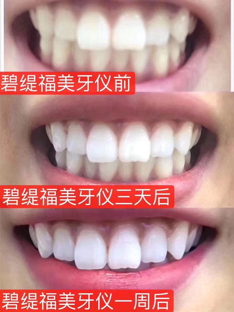 碧缇福美牙仪招合伙人