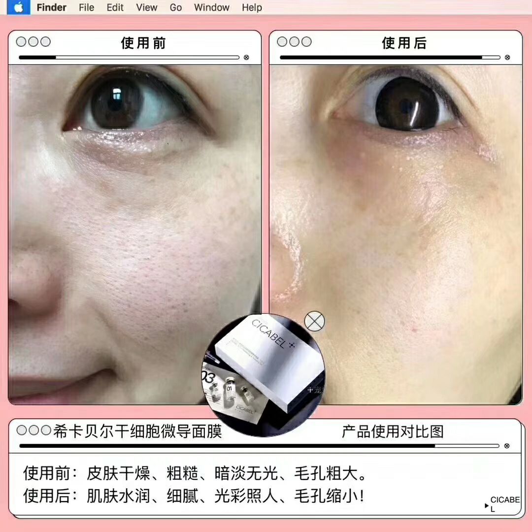 希卡贝尔干细胞面膜