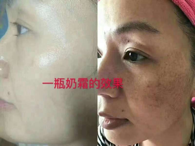去痘，去油，去痘印，万能奶霜