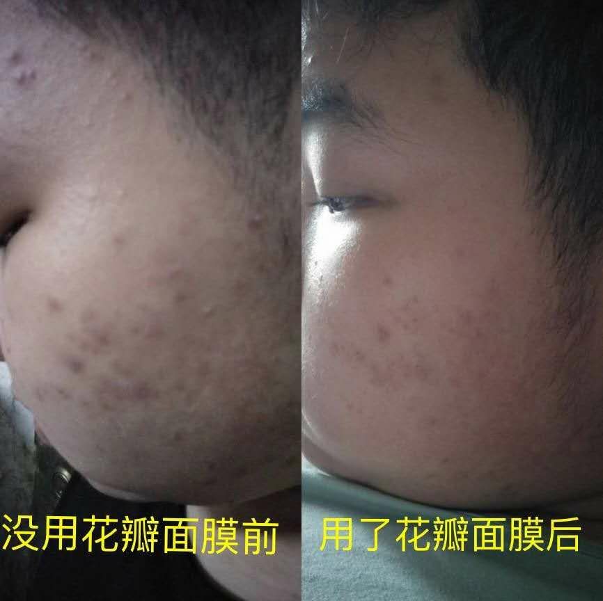 冰亦花瓣面膜，小仙女们都很喜欢