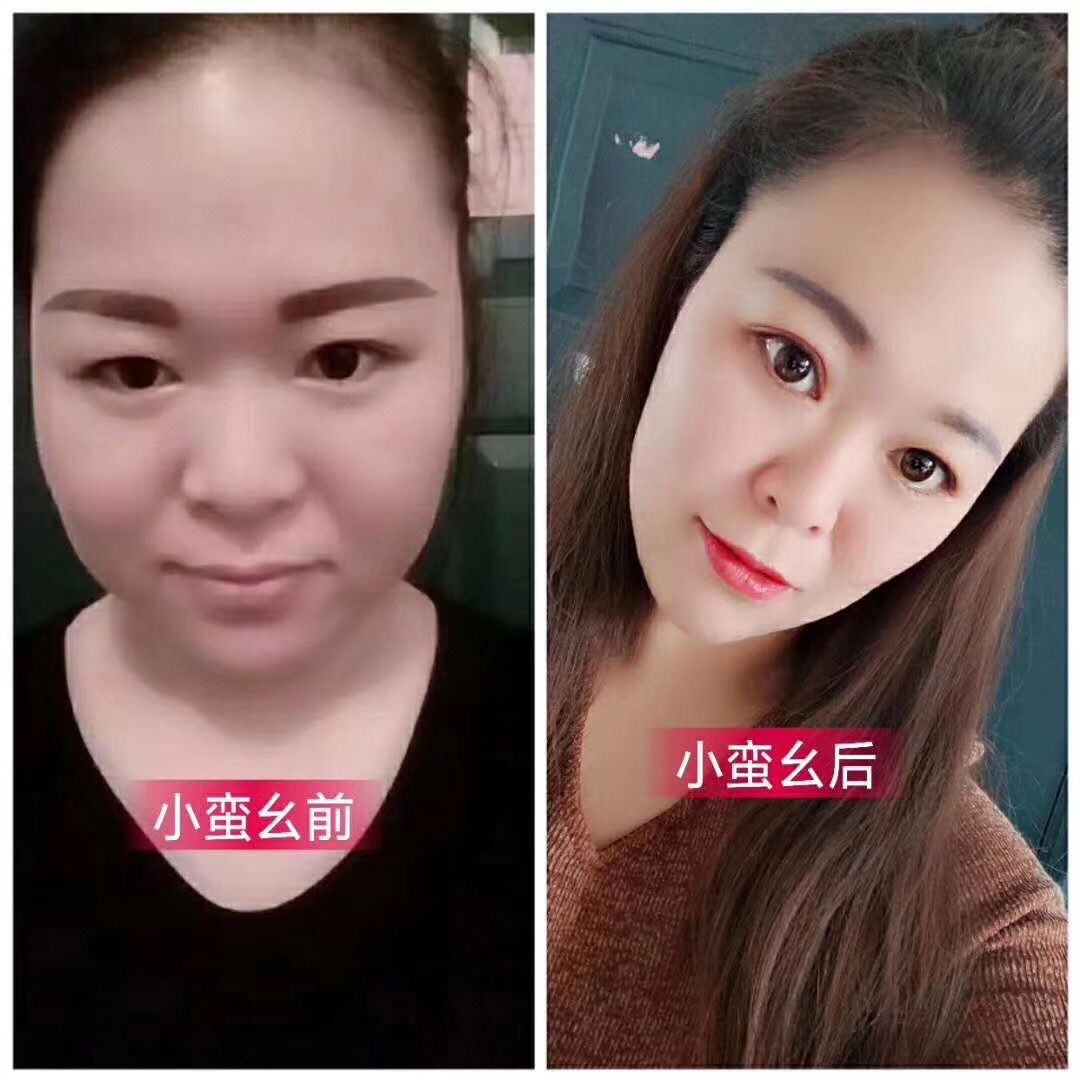小蛮幺抹抹瘦 瘦哪抹哪 操作就这么方便
