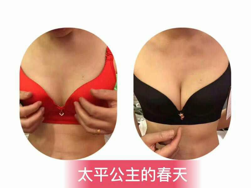 幸福小狐狸内衣招代理