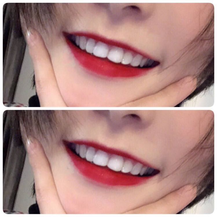 ❥认真坚持用过碧缇福美牙仪的人从来没有一个让我失望的[呲牙]