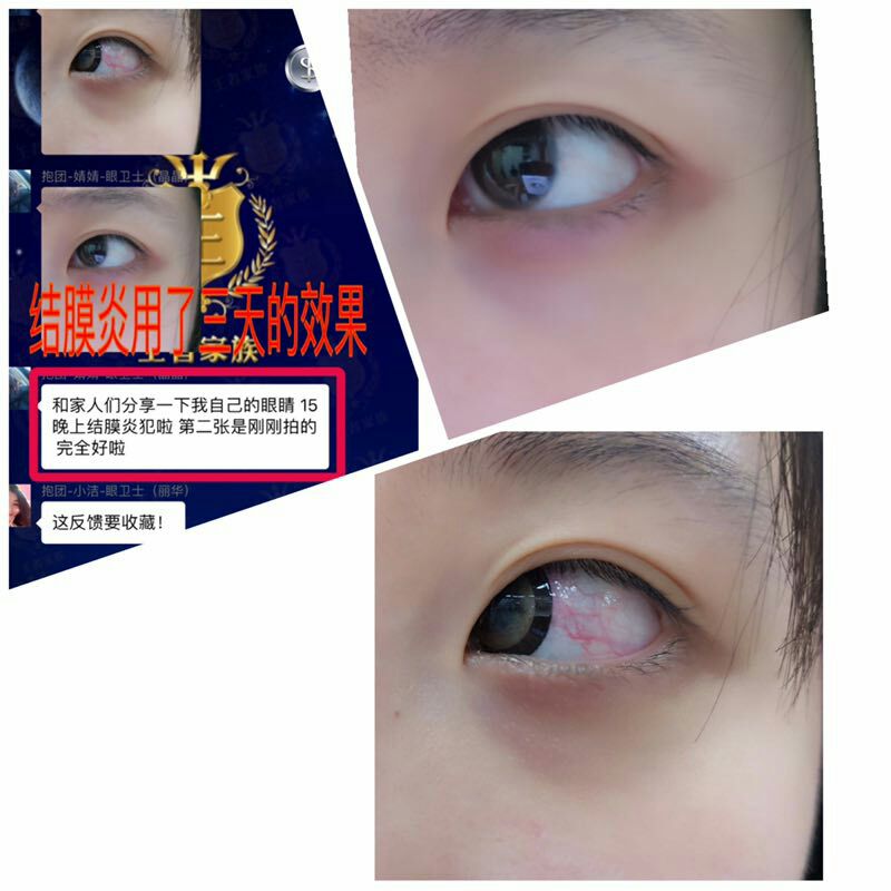 福瑞达医疗企业洗眼液
