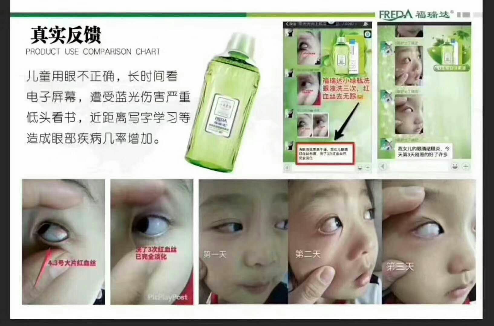 福瑞达心生爱洗眼液 玻尿酸诚招代理