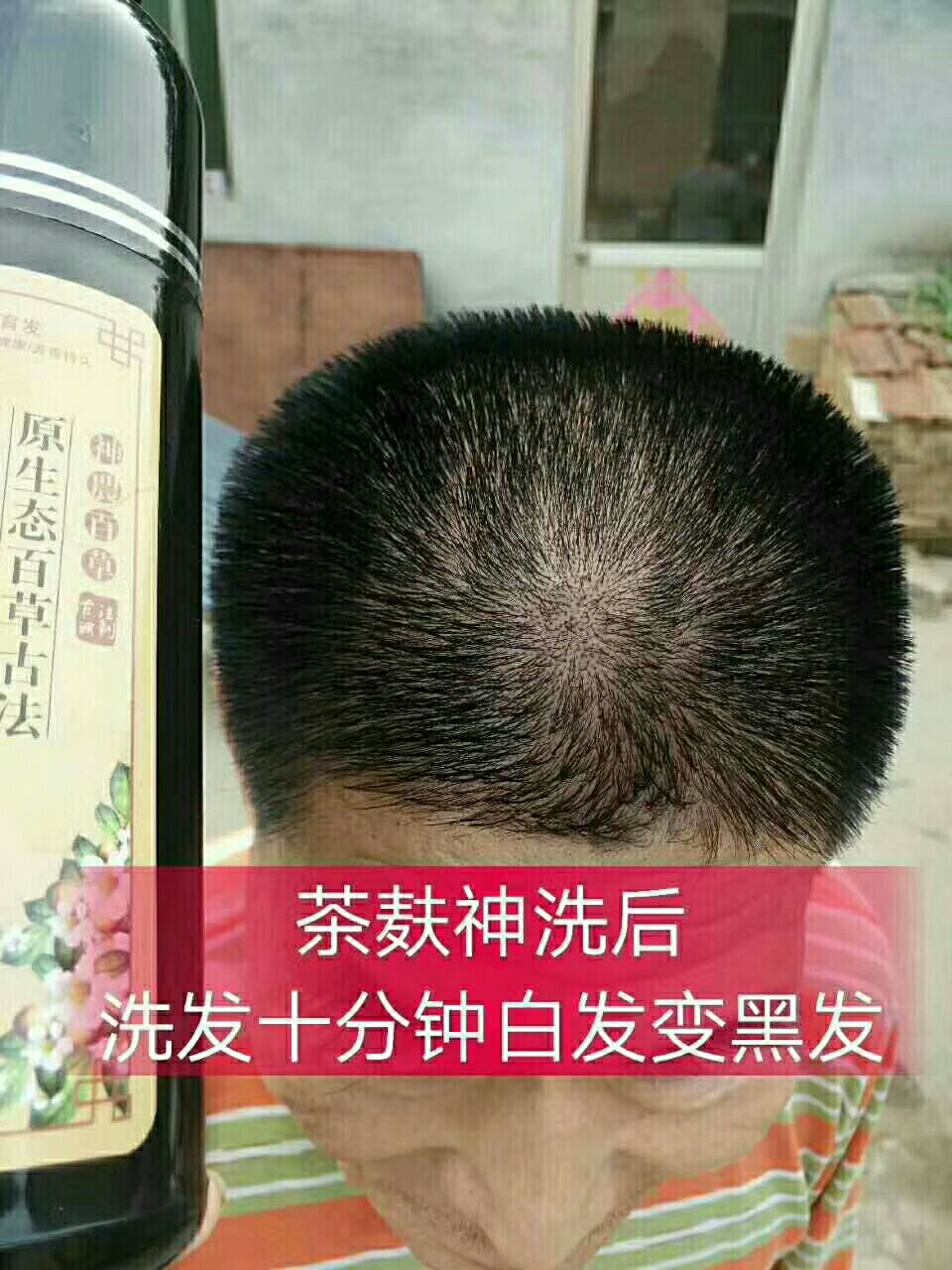 茶麸神洗 白发变成黑发 一款纯中药和植物合成 没有副作用