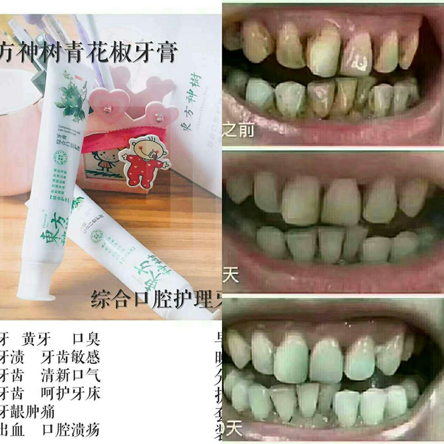 我们的东方神树青花椒牙膏，全国招代理