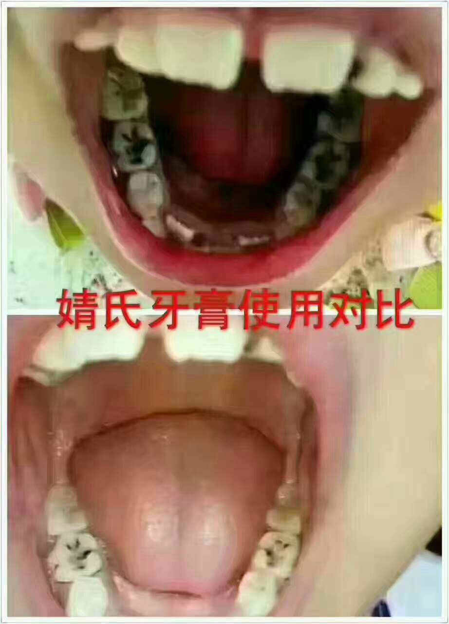 你有口腔困扰吗？