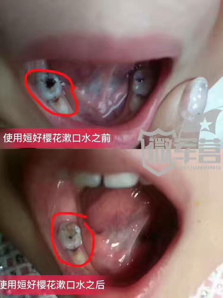 神奇口腔护理专家 267招收代理 自用+分享